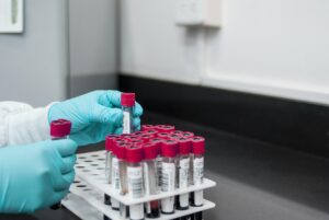 ワキガ手術の剪除法にかかる費用とダウンタイムはどのくらい？